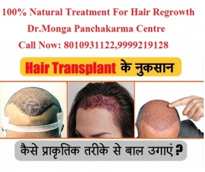 Hair Loss Treatment For Men Without Side Effects